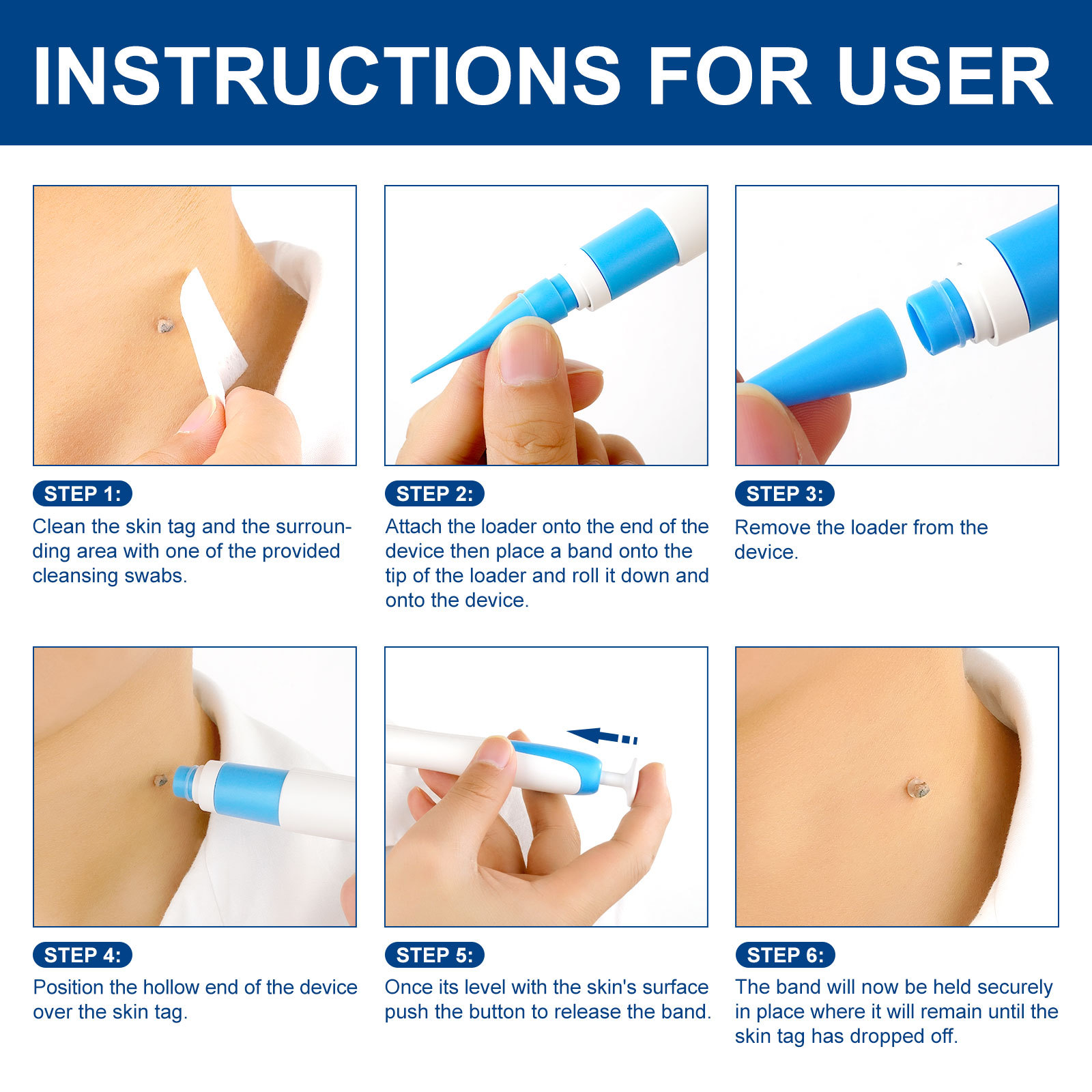 2-IN-1 Auto Skin Tag Removal K - Home Improvement And Tools บทวิจารณ์และราคา